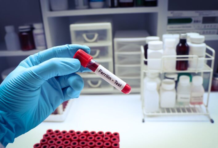 Test ferritina in Farmacia Olona - Gornate olona (VA)